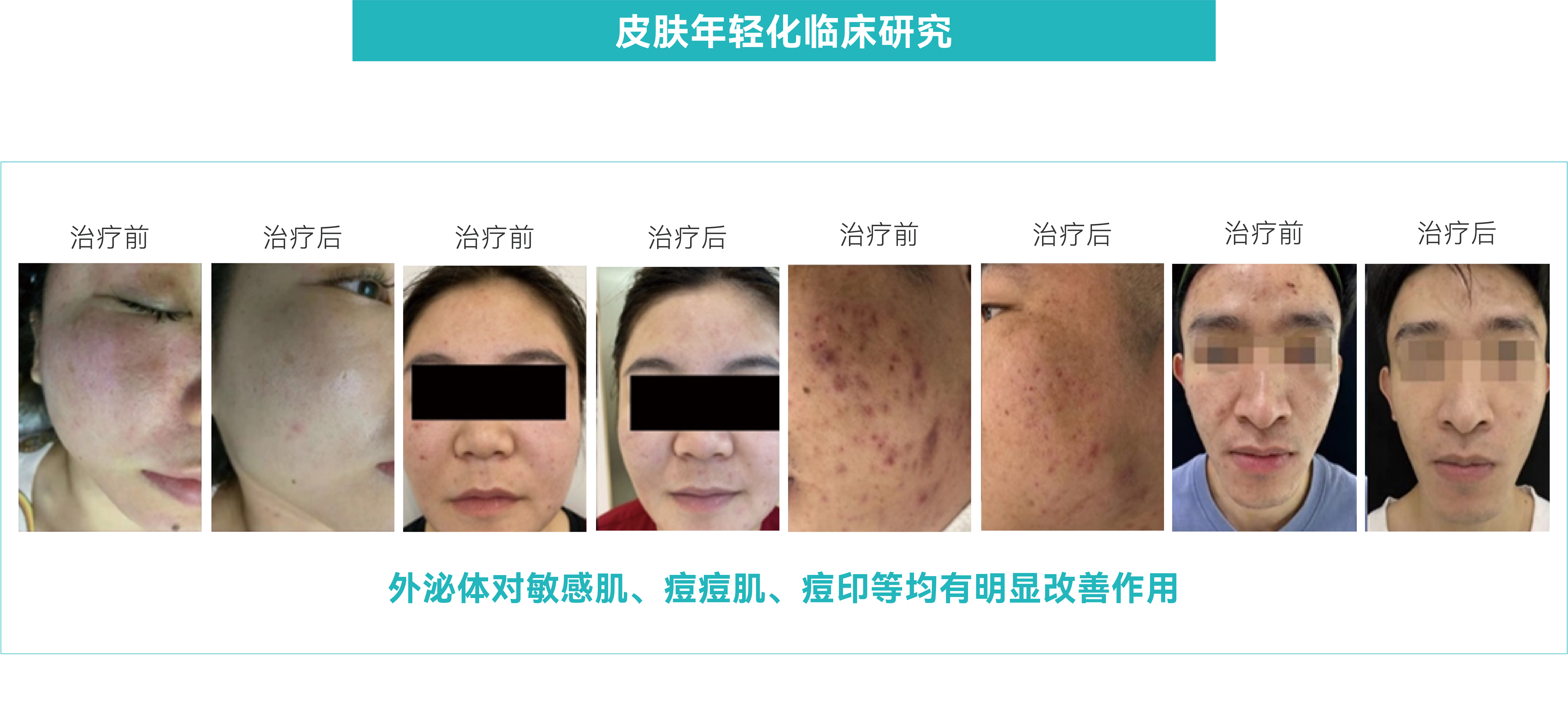 外泌体大规模制备应用方案-07.png